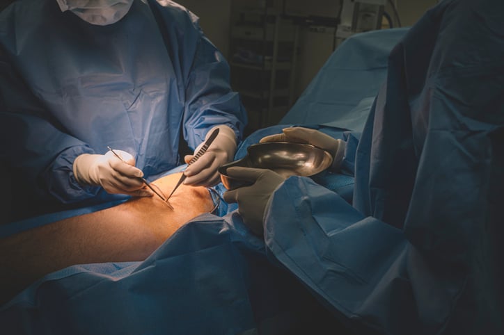 a group of surgeon and nurses operating on a chinese male patient's leg in operating room