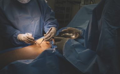 a group of surgeon and nurses operating on a chinese male patient’s leg in operating room a group of surgeon and nurses operating on a chinese male patient's leg in operating room