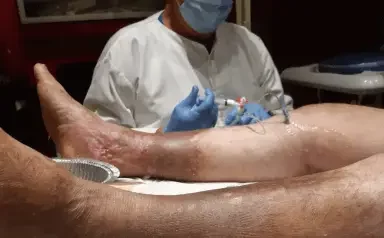 Tratamento